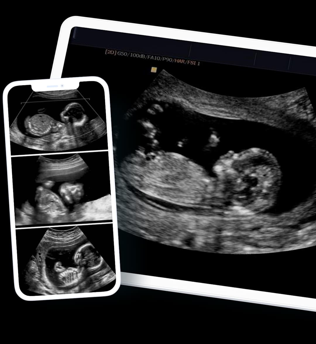 Ultrasound scan images on phone and tablet harley street ultrasound
