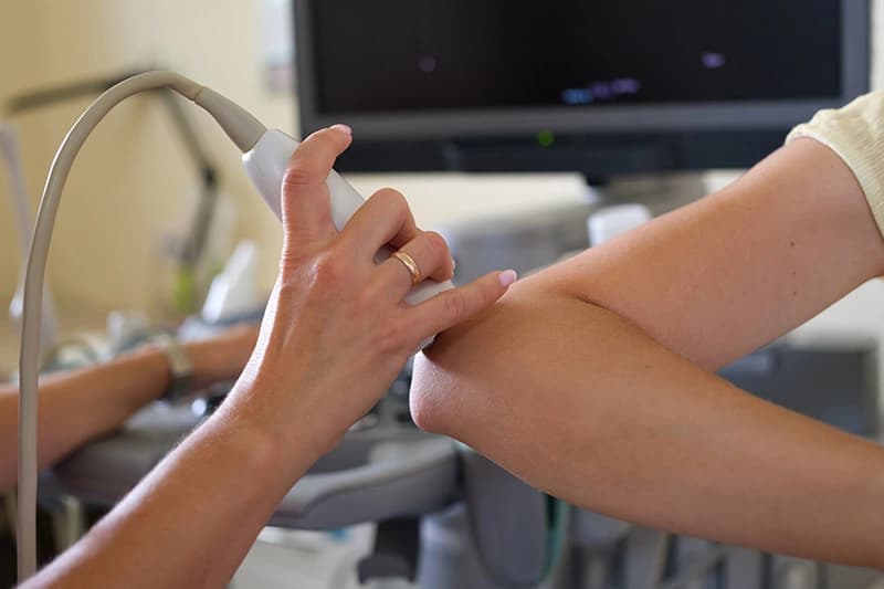 Elbow Lumps: Causes, symptoms and how an ultrasound can help with diagnosis